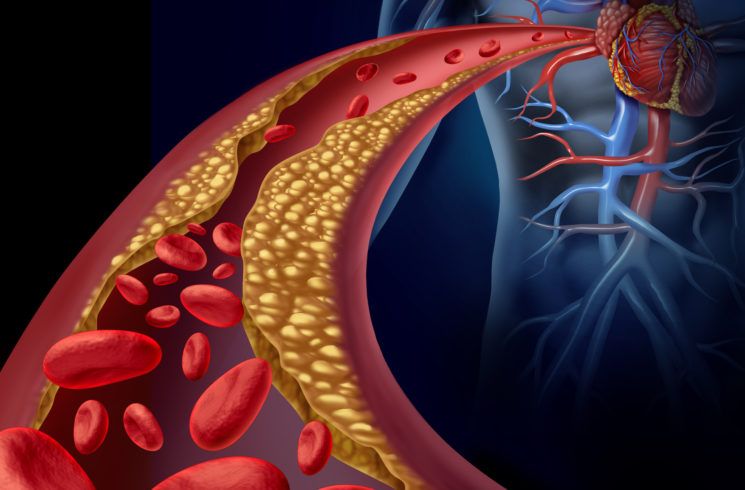 Cleveland Clinic comparte 4 maneras de ayudar a reducir el riesgo de enfermedades del corazón