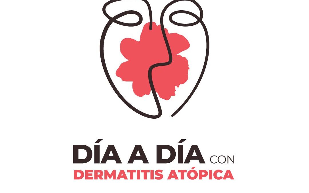 Lanzan "Día a día con Dermatitis Atópica", plataforma digital educativa para personas que viven con dermatitis atópica