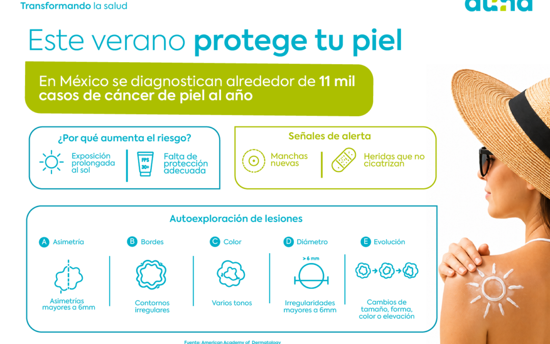 Vacaciones de verano elevan la exposición al sol y, con ello, los casos de cáncer de piel en México